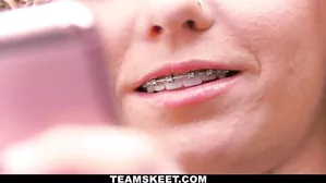 Beautiful Blinding Braces